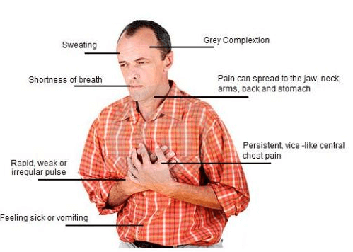 Heart attack symptoms